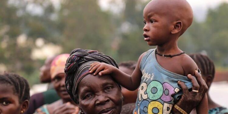 WHO Sebut 1 Juta Anak Kongo Terancam Kekurangan Gizi Akut 1 Pengungsi Kongo yang dimana terdapat banyak anak-anak.