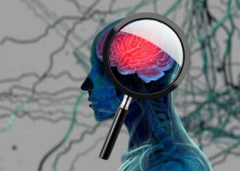 Ilustrasi Alzheimer.