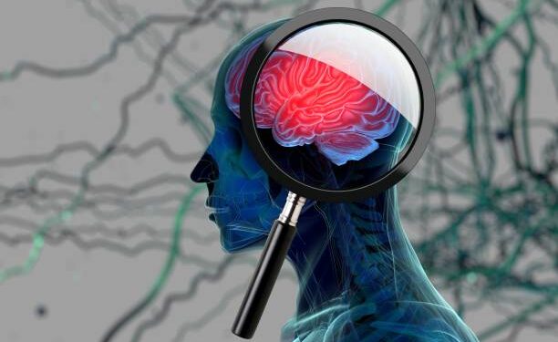 Ilustrasi Alzheimer.