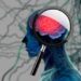Hati-hati, Hipertensi Tidak Dikendalikan Bisa Tingkatkan Risiko Alzheimer 2 Ilustrasi Alzheimer.