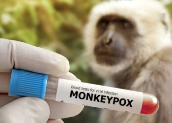 Ilustrasi Monkeypox.