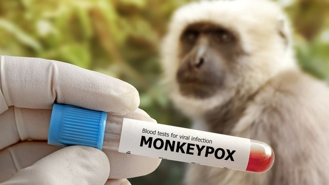 DKI Jakarta Catat 11 Kasus Mpox Sepanjang 2024, Berikut Daerah Penyebarannya 1 Ilustrasi Monkeypox.